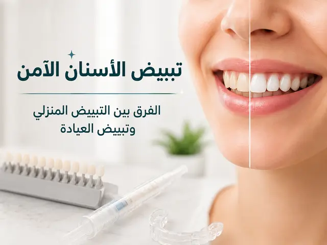 تبييض الأسنان الآمن: كيف تحصل على ابتسامة أفتح بدون حساسية؟